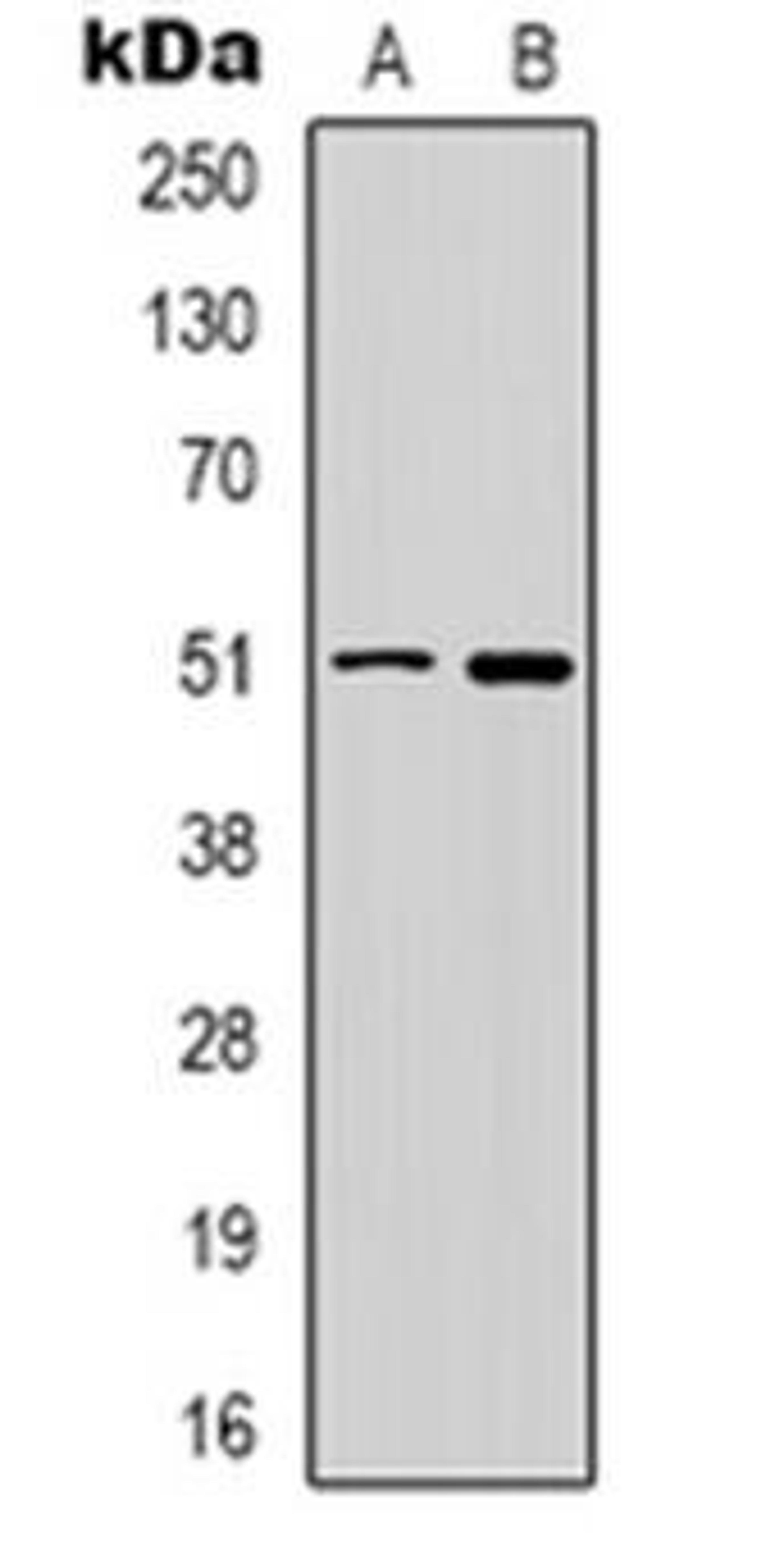 Western blot analysis of GABRD expression in HT29 (Lane 1), PC12 (Lane 2) whole cell lysates using GABRD antibody