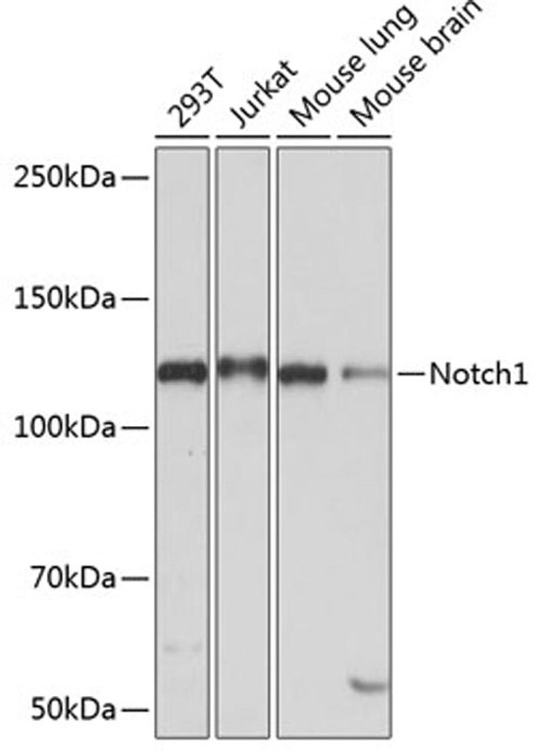 Western blot - Notch1 antibody (A19090)