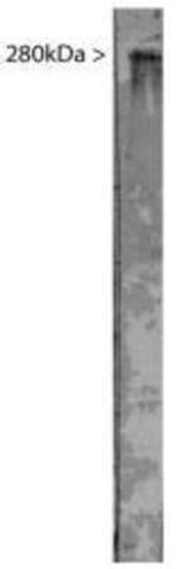 Western Blot: MAP2 Antibody [NB300-213] - Western blot analysis of MAP2 expression in bovine brain extract using NB300-213.