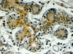 orb19130 (4ug/ml) staining of paraffin embedded Human Breast. Steamed antigen retrieval with citrate buffer pH 6, HRP-staining.