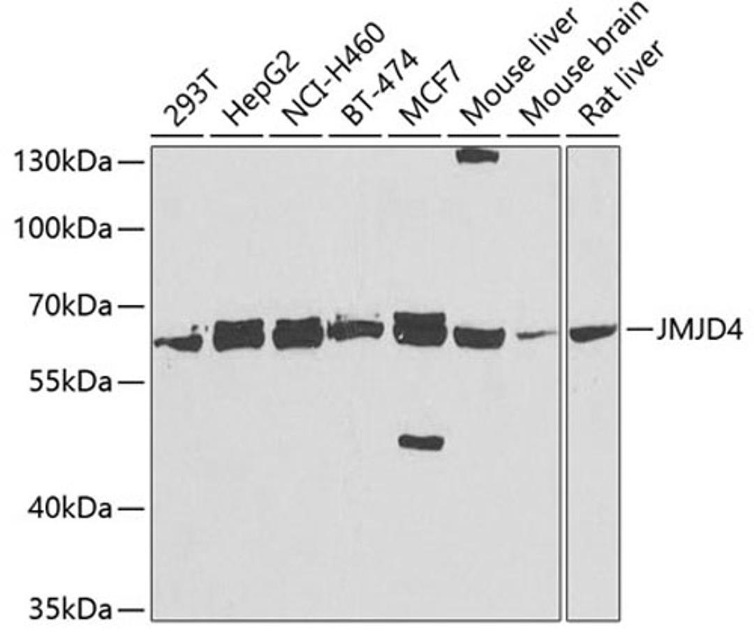 Western blot - JMJD4 antibody (A7992)