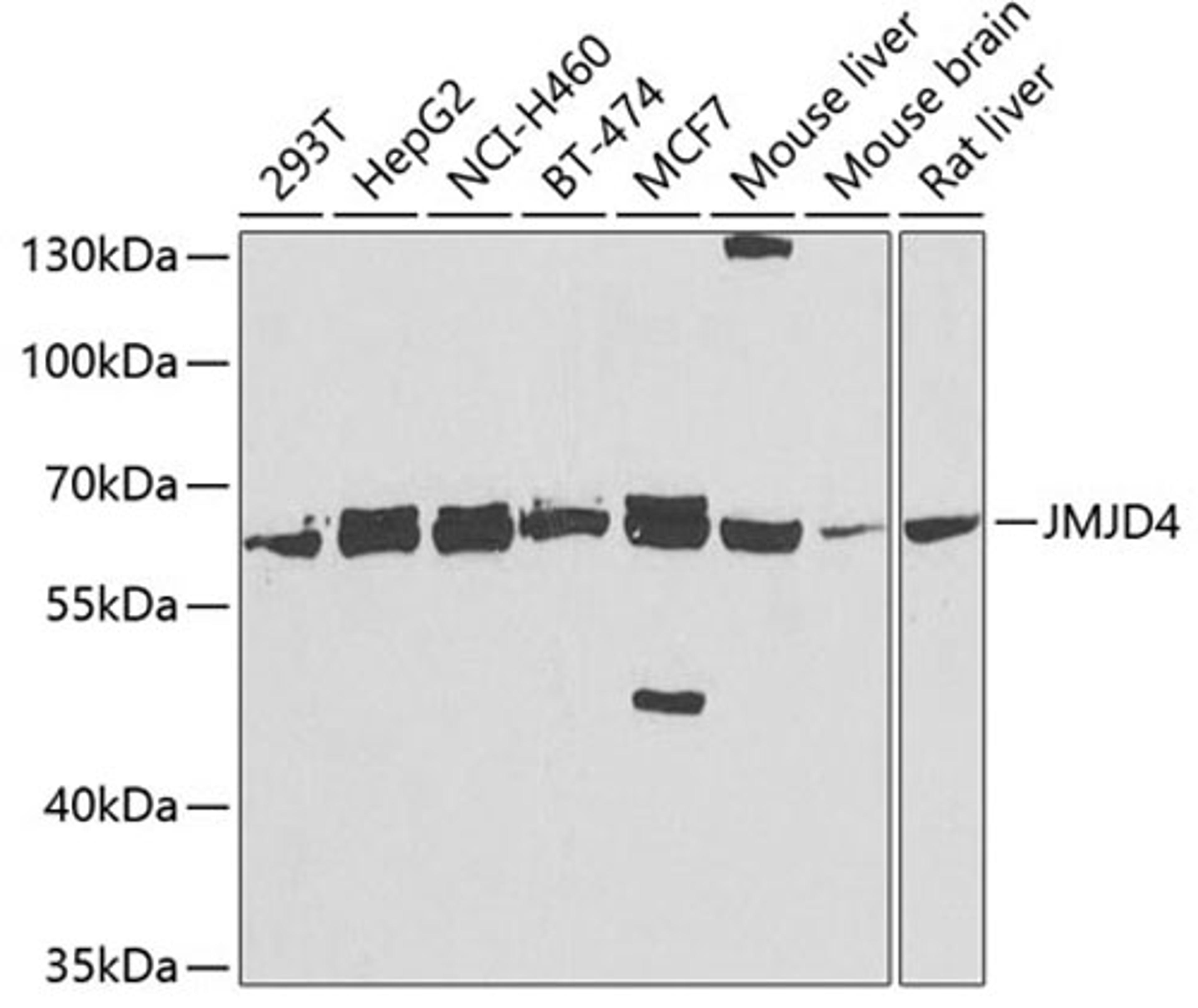 Western blot - JMJD4 antibody (A7992)