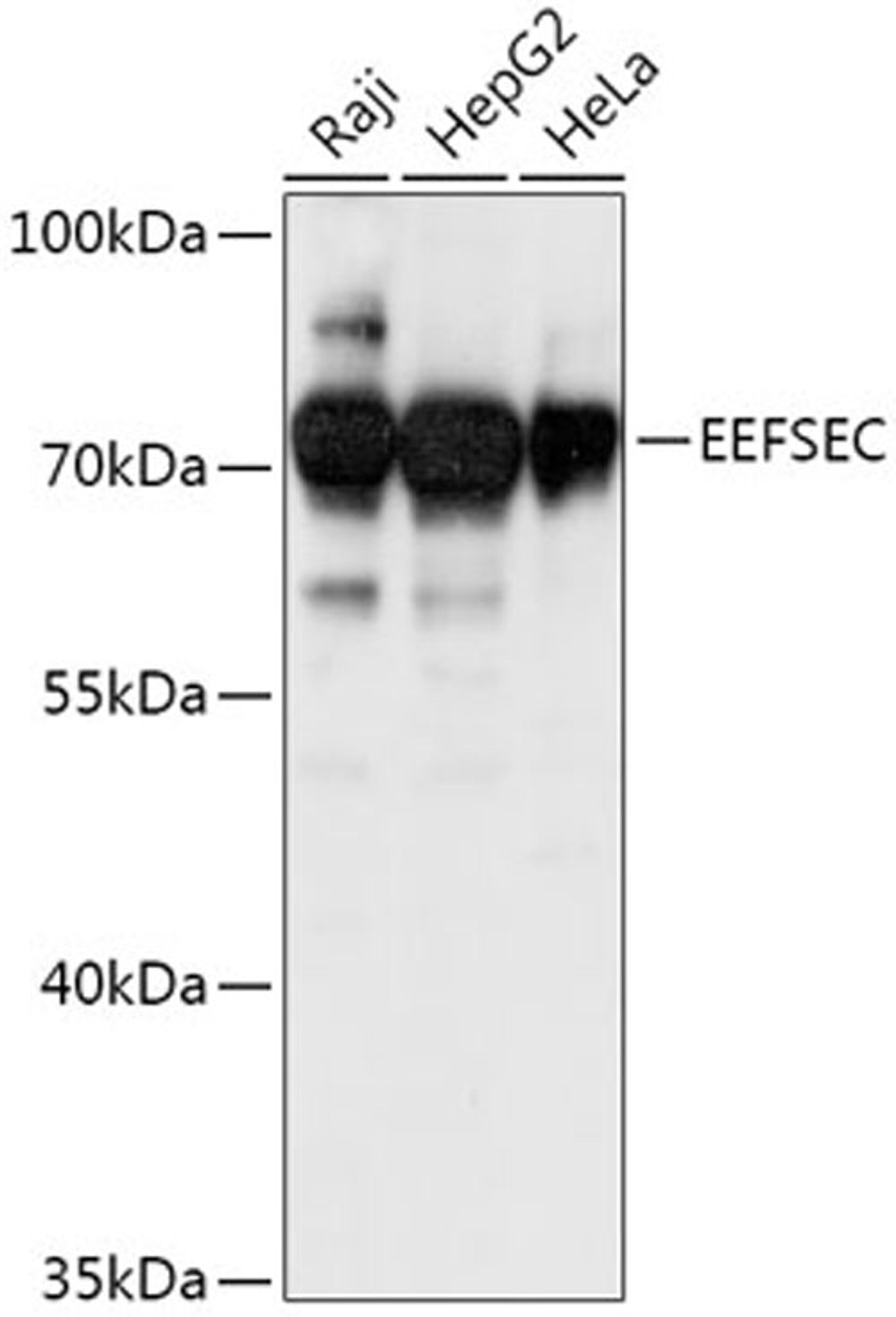 Western blot - EEFSEC antibody (A17749)