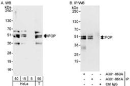 Detection of human FOP by western blot and immunoprecipitation.