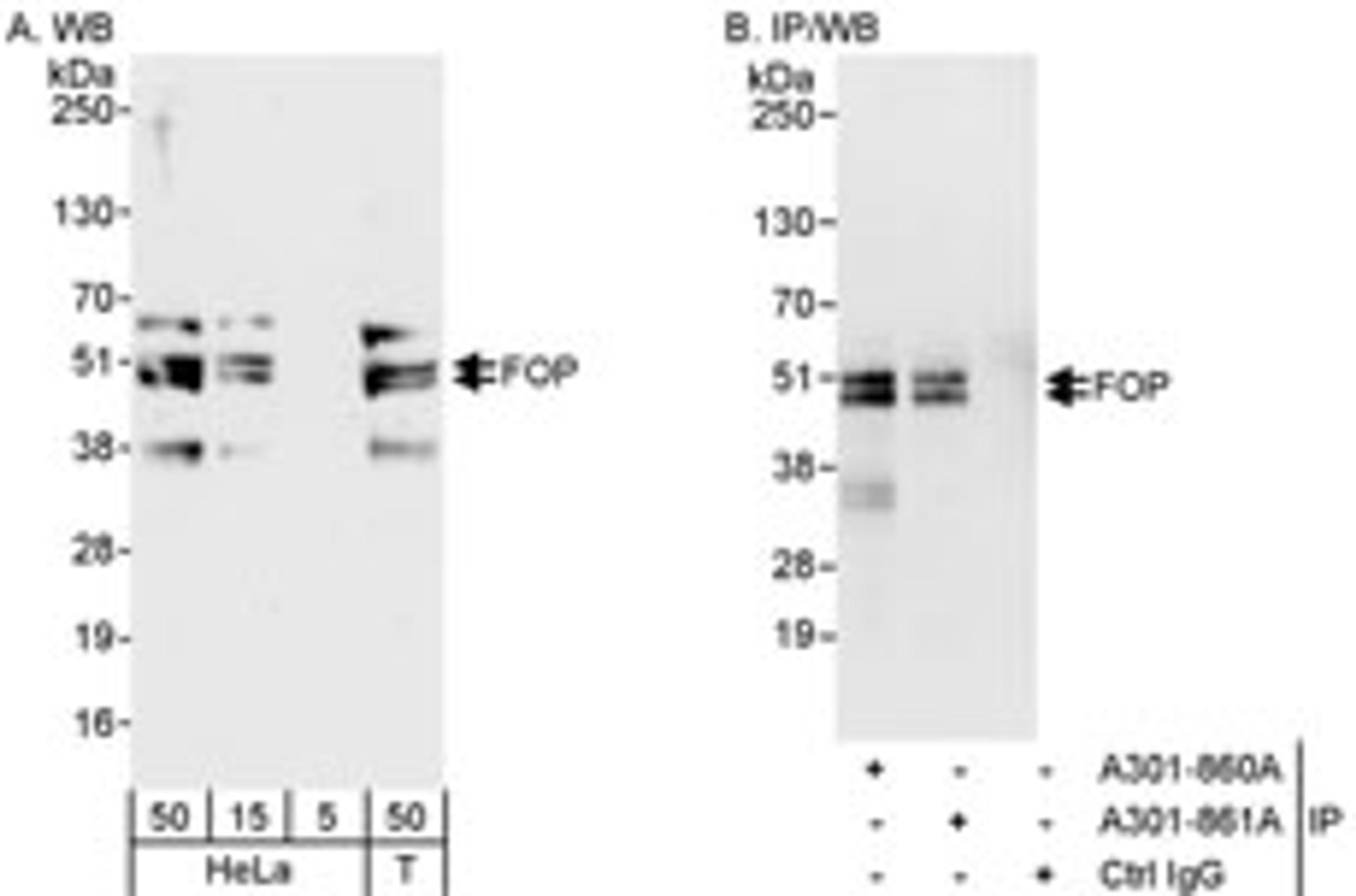 Detection of human FOP by western blot and immunoprecipitation.