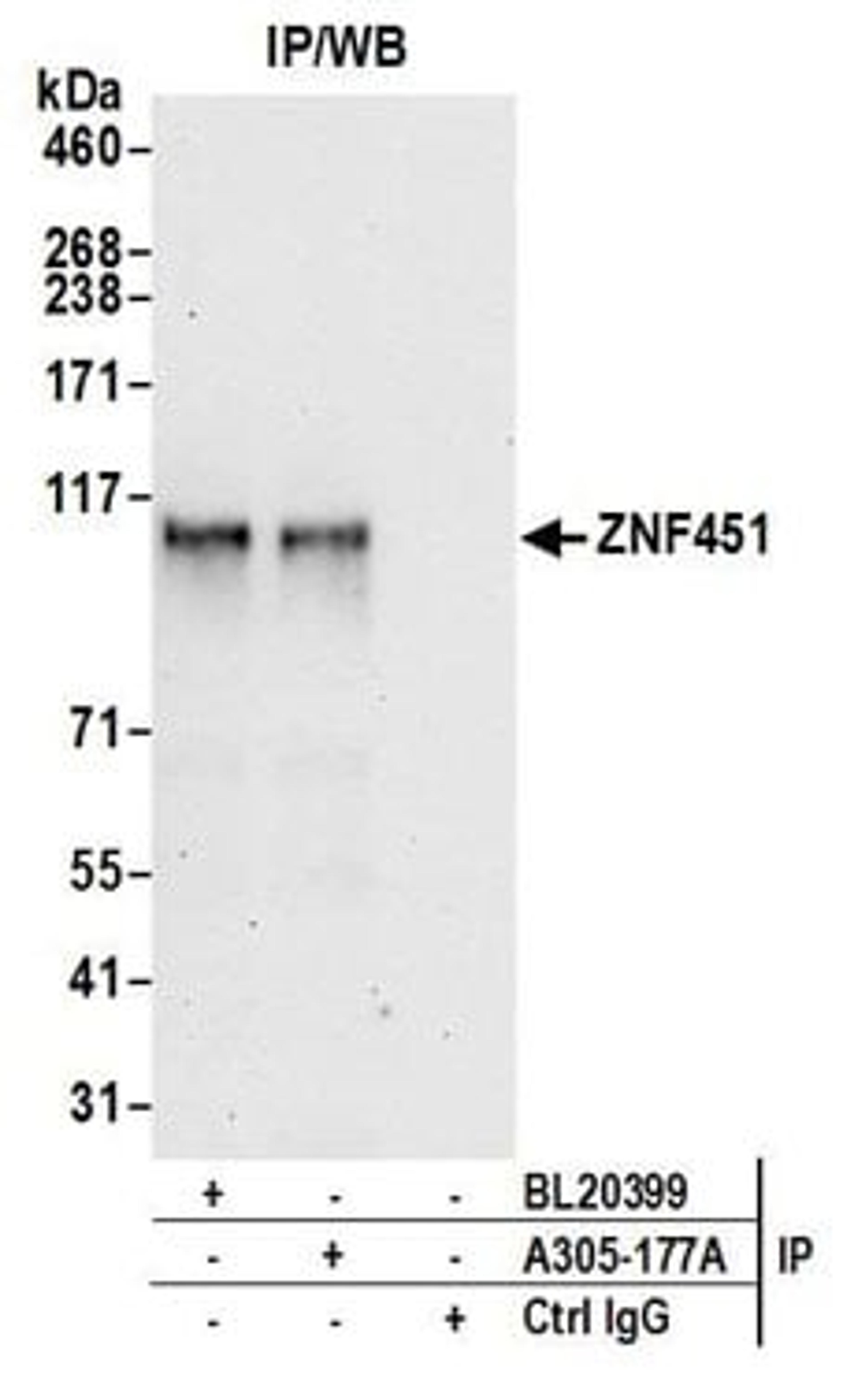 Detection of human ZNF451 by western blot of immunoprecipitates.