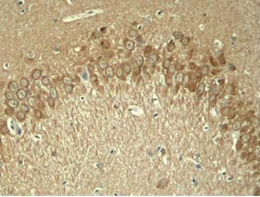 Immunohistochemical analysis of paraffin-embedded rat hippocampal region tissue from a model with AlzheimerÃ¯Â¿Â½s Disease using Tau (phospho-Thr181) antibody