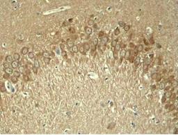 Immunohistochemical analysis of paraffin-embedded rat hippocampal region tissue from a model with AlzheimerÃ¯Â¿Â½s Disease using Tau (phospho-Thr181) antibody