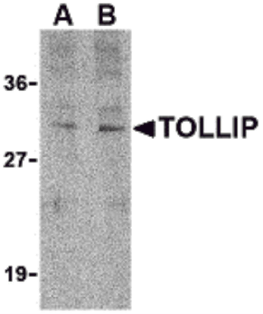 Western blot analysis of TOLLIP in rat brain cell lysate with TOLLIP antibody at (A) 1 and (B) 2 &#956;g/mL.