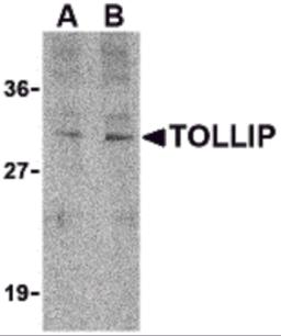 Western blot analysis of TOLLIP in rat brain cell lysate with TOLLIP antibody at (A) 1 and (B) 2 &#956;g/mL.