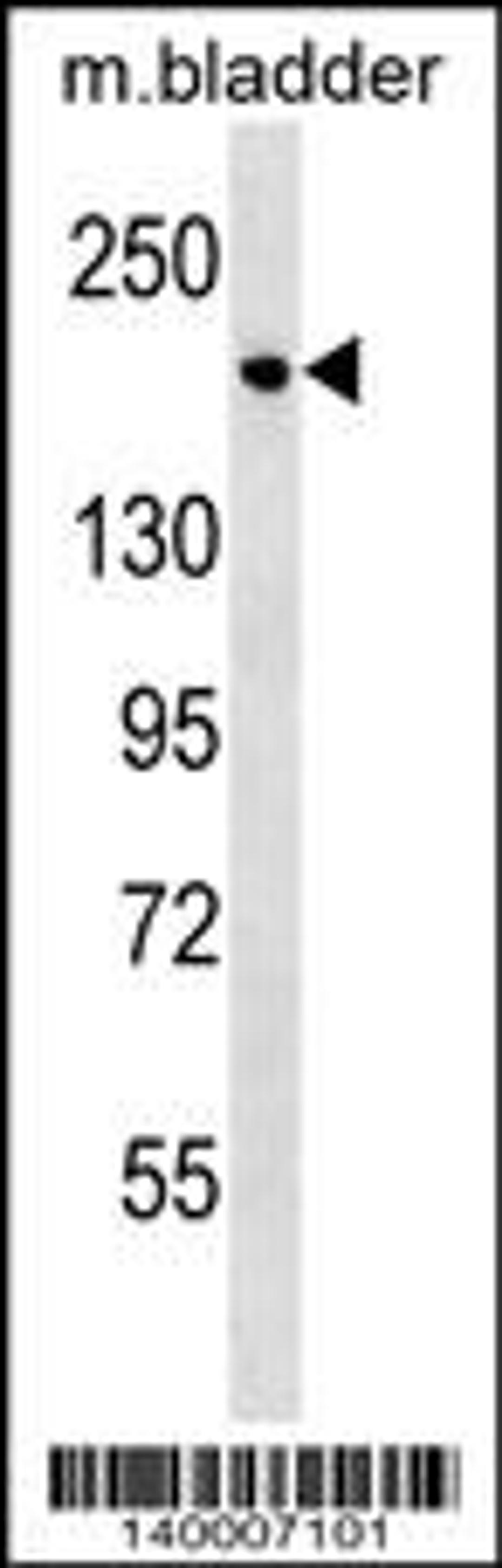 Western blot analysis in mouse bladder tissue lysates (35ug/lane).