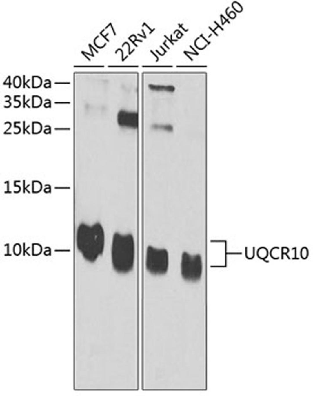 Western blot - UQCR10 antibody (A4674)