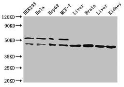 Western Blot. Positive WB detected in: HEK293 whole cell lysate, Hela whole cell lysate, HepG2 whole cell lysate, MCF-7 whole cell lysate, Rat liver tissue, Mouse brain tissue, Mouse liver tissue, Mouse kidney tissue. All lanes: IDH1 antibody at 2ug/ml. Secondary. Goat polyclonal to rabbit IgG at 1/50000 dilution. Predicted band size: 47 kDa. Observed band size: 47, 52 kDa. 