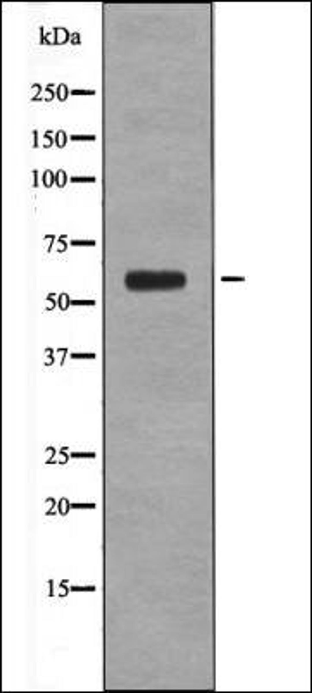 Western blot analysis of heatshockK562 whole cell lysates using Cyclin B1 -Phospho-Ser133- antibody