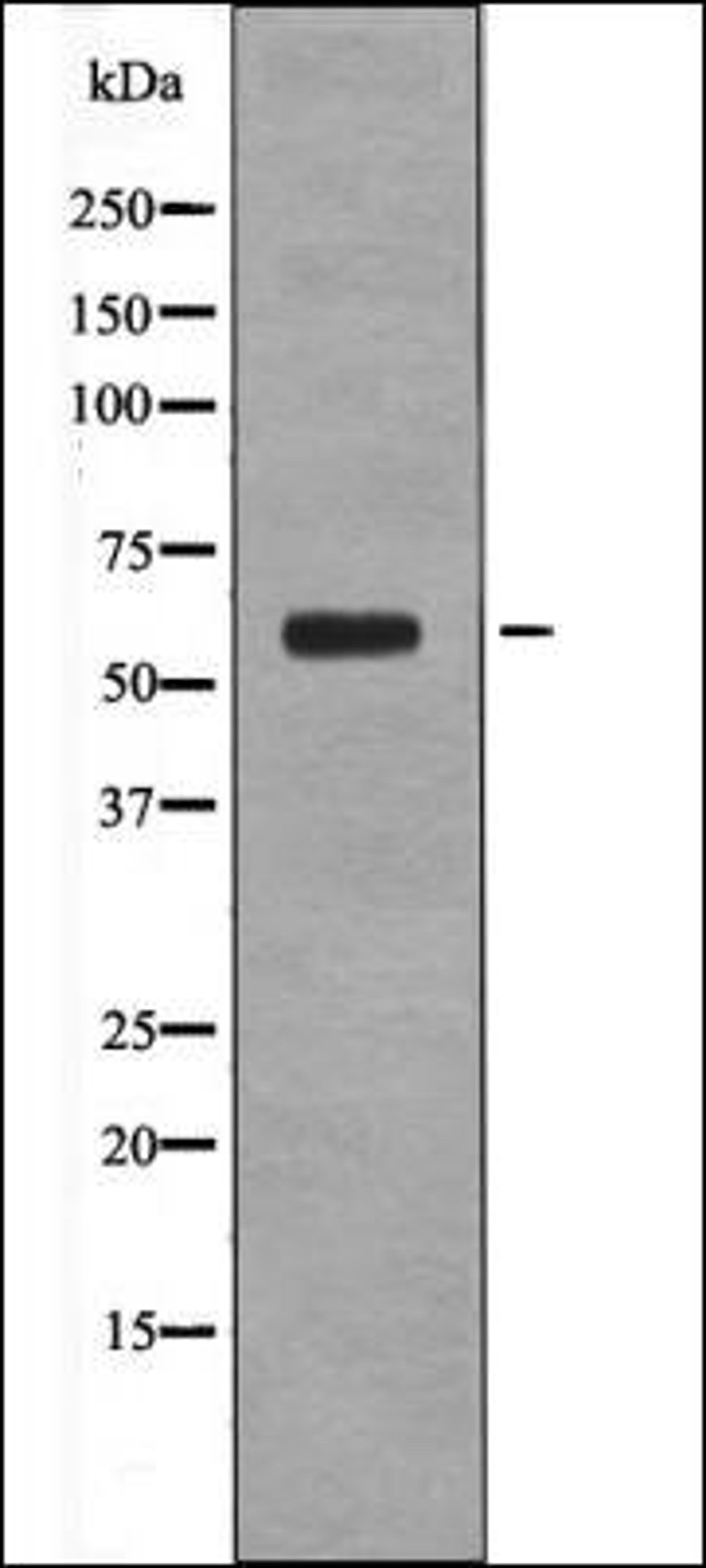 Western blot analysis of heatshockK562 whole cell lysates using Cyclin B1 -Phospho-Ser133- antibody