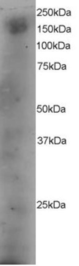 45-489 staining (4ug/ml) of A431 lysate (RIPA buffer, 35ug total protein per lane). Primary incubated for 12 hour. Detected by western blot using chemiluminescence.