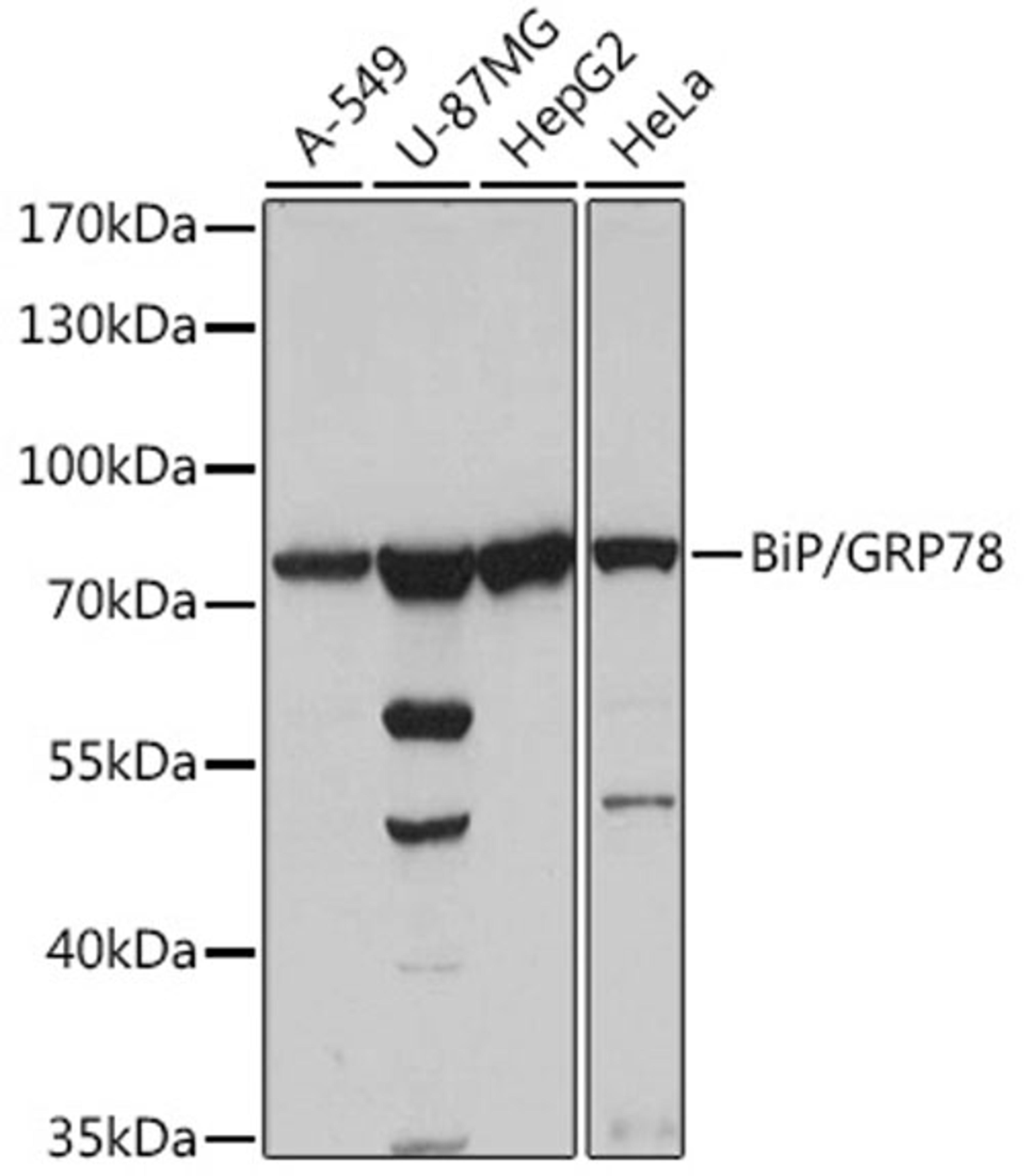 Western blot - HSPA5 antibody (A0241)