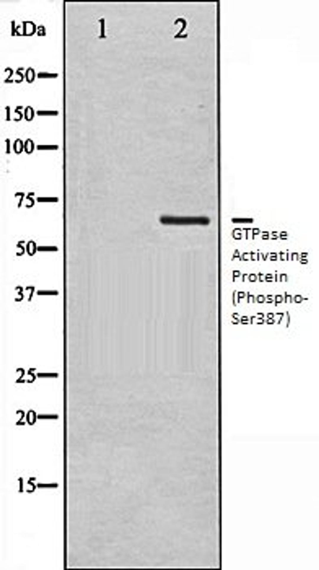 Western blot analysis of COS7 whole cell lysates using GTPase Activating Protein (Phospho-Ser387) antibody, The lane on the left is treated with the antigen-specific peptide.