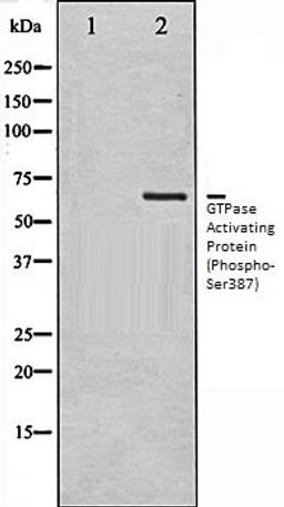 Western blot analysis of COS7 whole cell lysates using GTPase Activating Protein (Phospho-Ser387) antibody, The lane on the left is treated with the antigen-specific peptide.