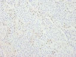 Detection of human CDT1 by immunohistochemistry.