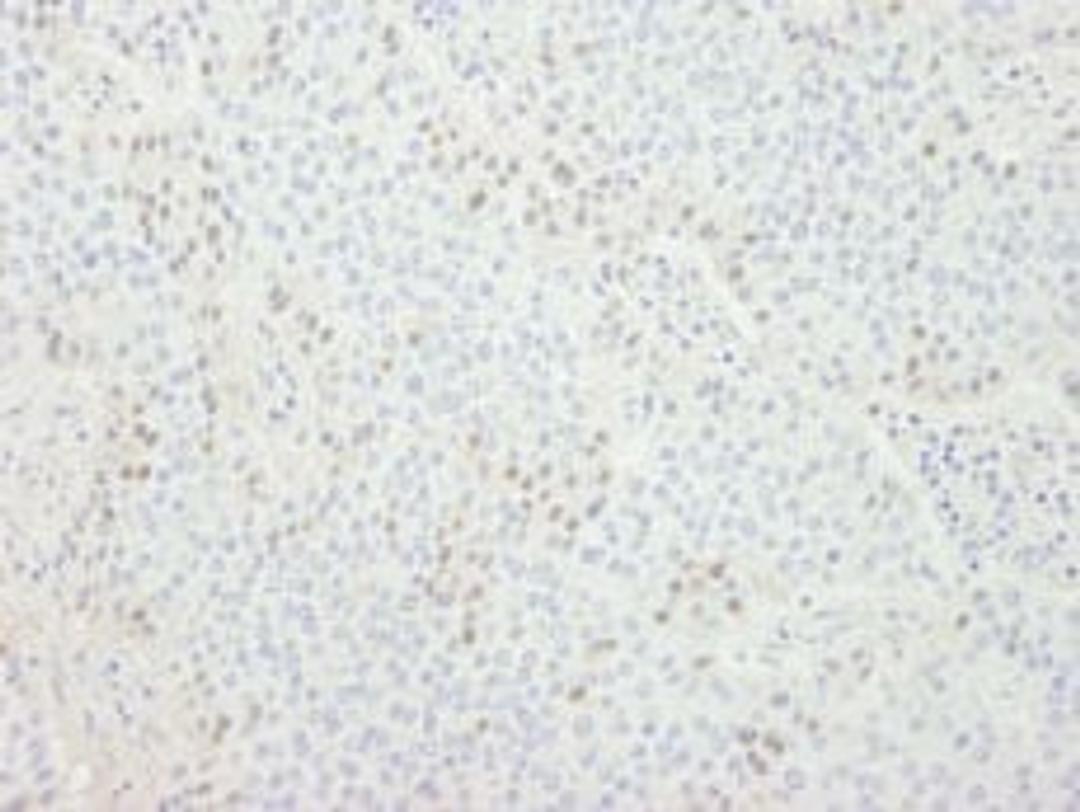 Detection of human CDT1 by immunohistochemistry.