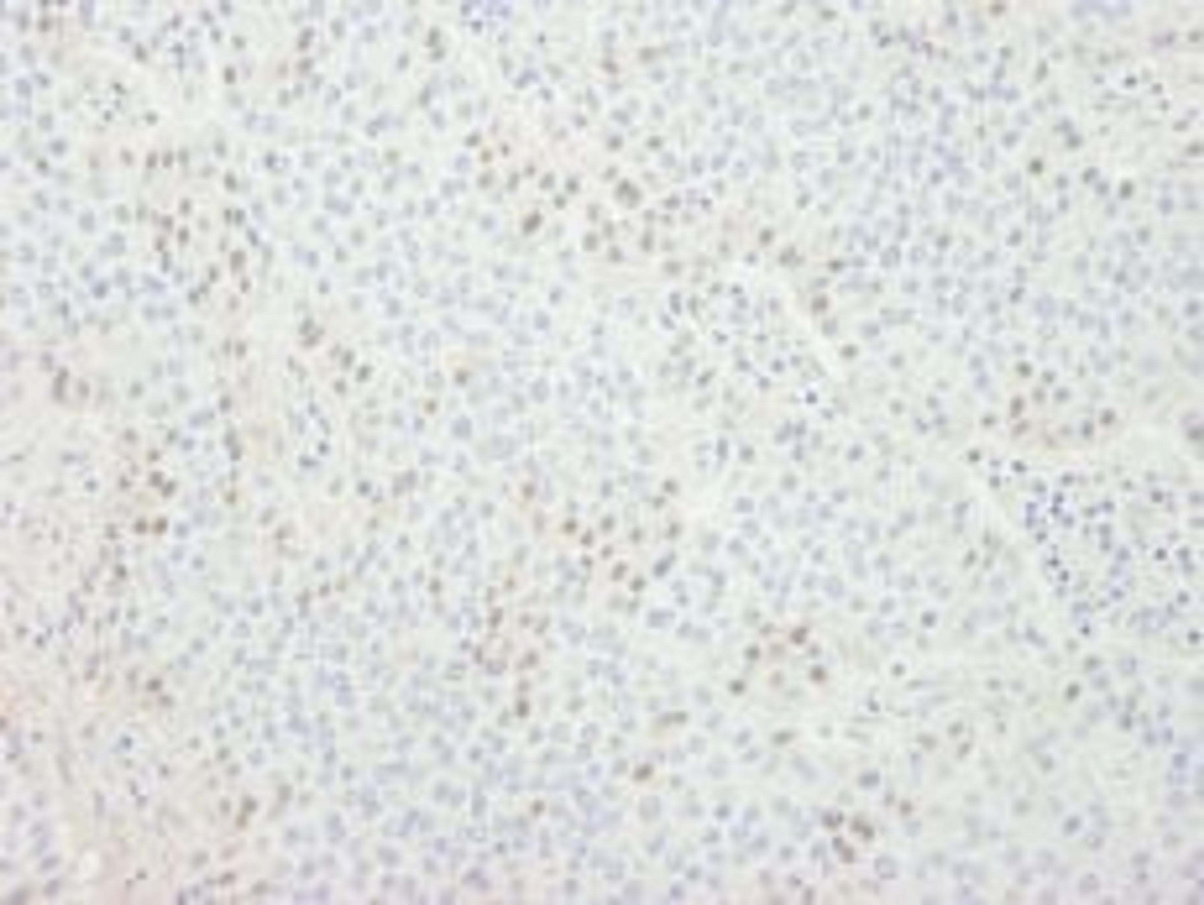 Detection of human CDT1 by immunohistochemistry.