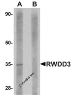 Western blot analysis of RWDD3 in rat kidney tissue lysate with RWDD3 antibody at 1 &#956;g/mL in (A) the absence and (B) the presence of blocking peptide. 