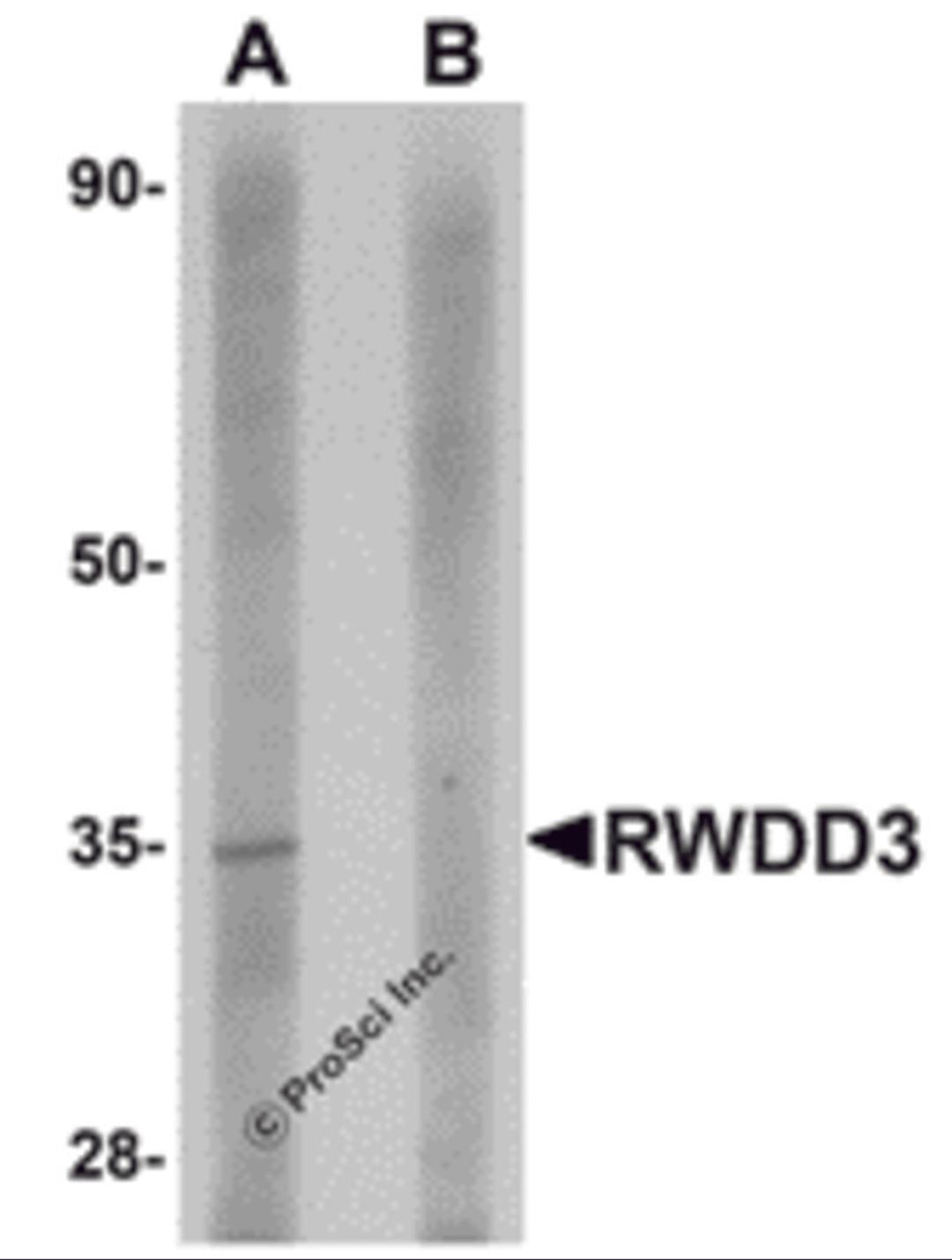 Western blot analysis of RWDD3 in rat kidney tissue lysate with RWDD3 antibody at 1 μg/mL in (A) the absence and (B) the presence of blocking peptide.