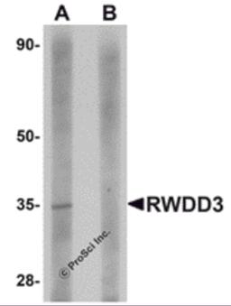Western blot analysis of RWDD3 in rat kidney tissue lysate with RWDD3 antibody at 1 μg/mL in (A) the absence and (B) the presence of blocking peptide.