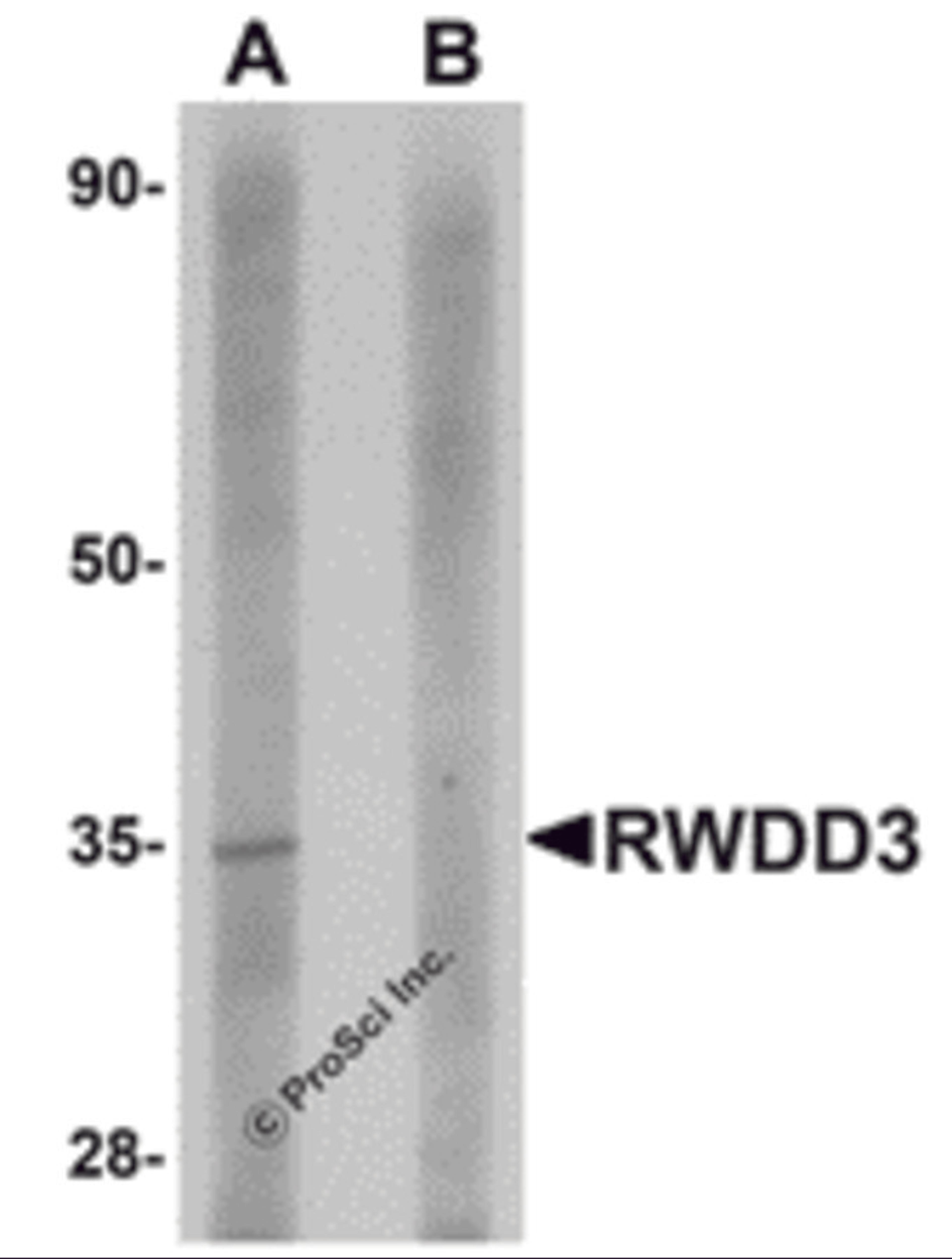 Western blot analysis of RWDD3 in rat kidney tissue lysate with RWDD3 antibody at 1 μg/mL in (A) the absence and (B) the presence of blocking peptide.