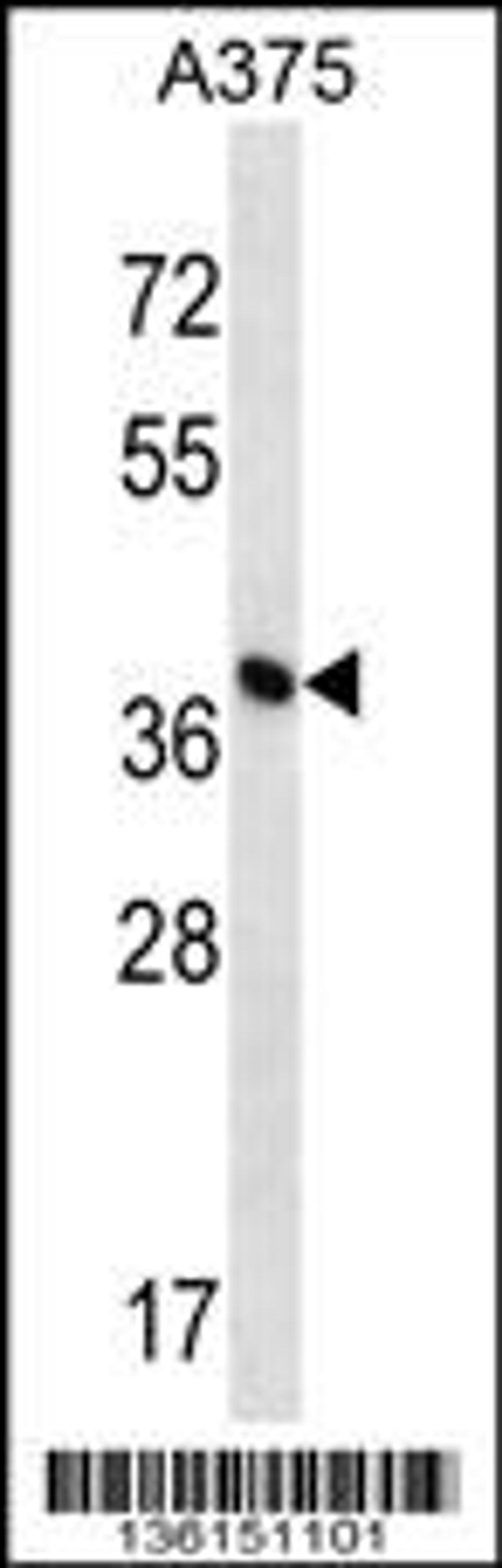 Western blot analysis in A375 cell line lysates (35ug/lane).