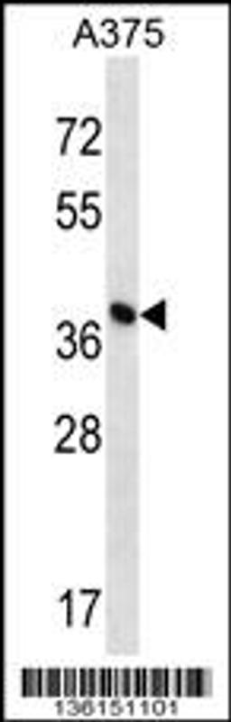 Western blot analysis in A375 cell line lysates (35ug/lane).