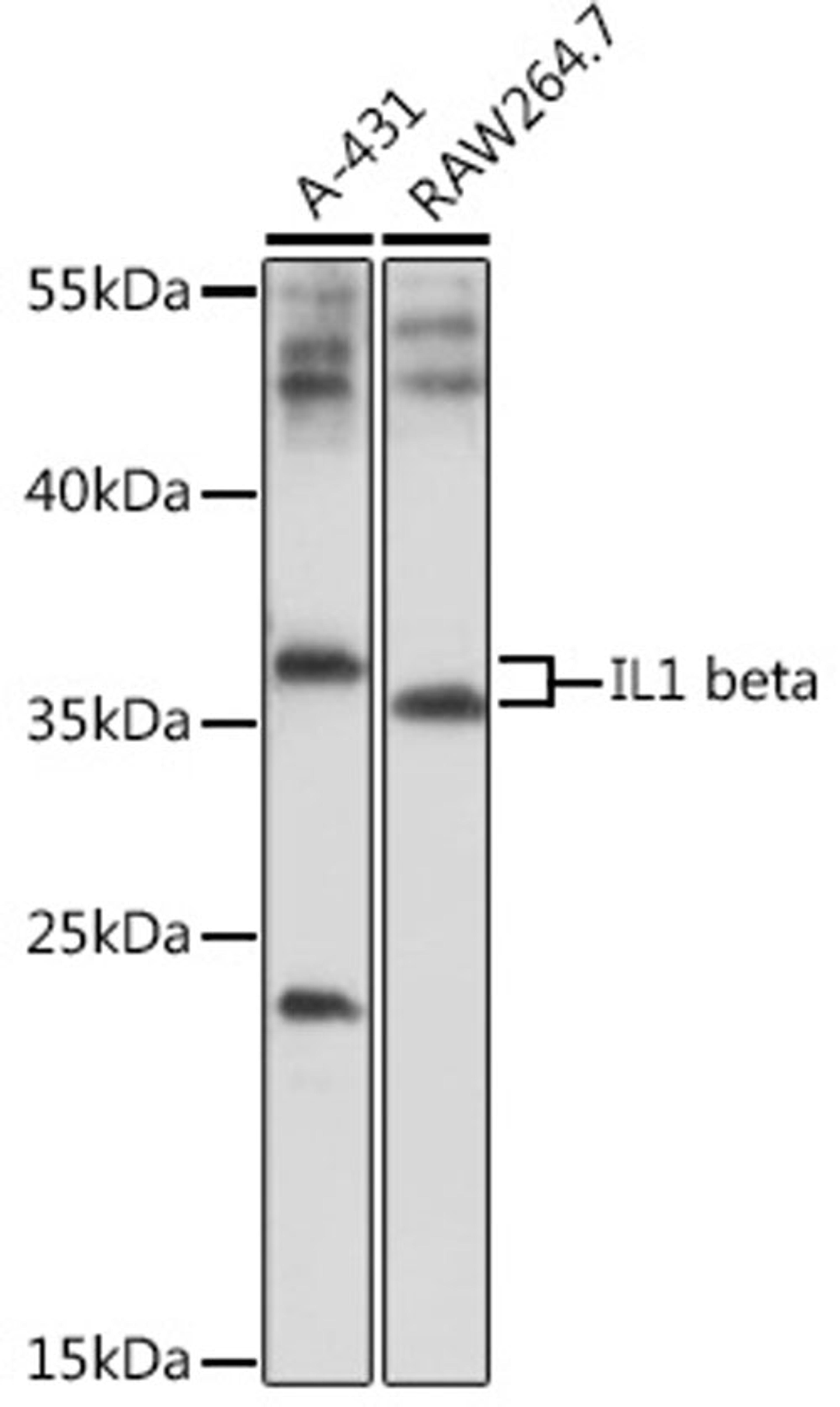 Western blot - IL1 beta antibody (A17361)