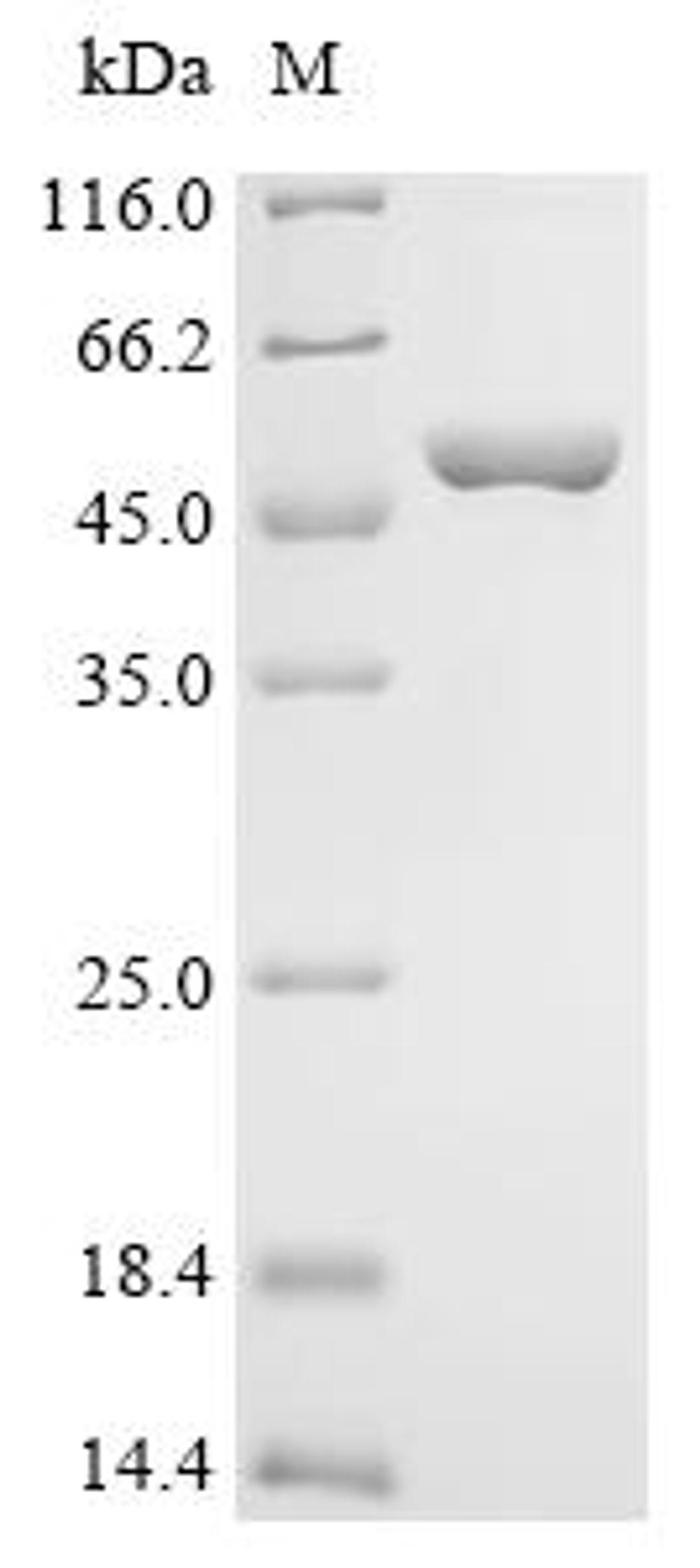 (Tris-Glycine gel) Discontinuous SDS-PAGE (reduced) with 5% enrichment gel and 15% separation gel.