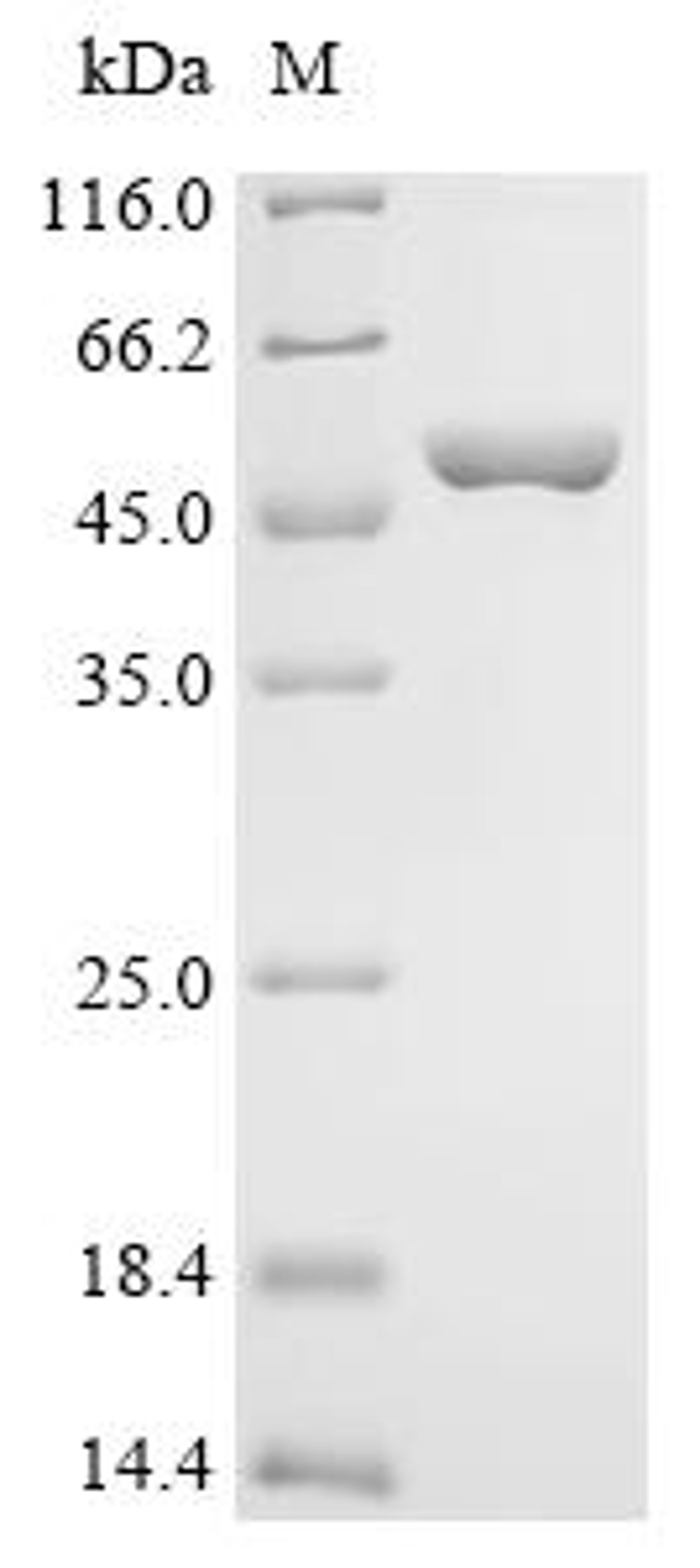 (Tris-Glycine gel) Discontinuous SDS-PAGE (reduced) with 5% enrichment gel and 15% separation gel.