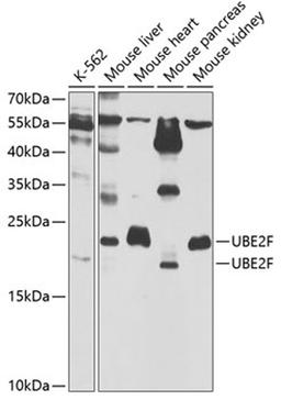 Western blot - UBE2F antibody (A5160)