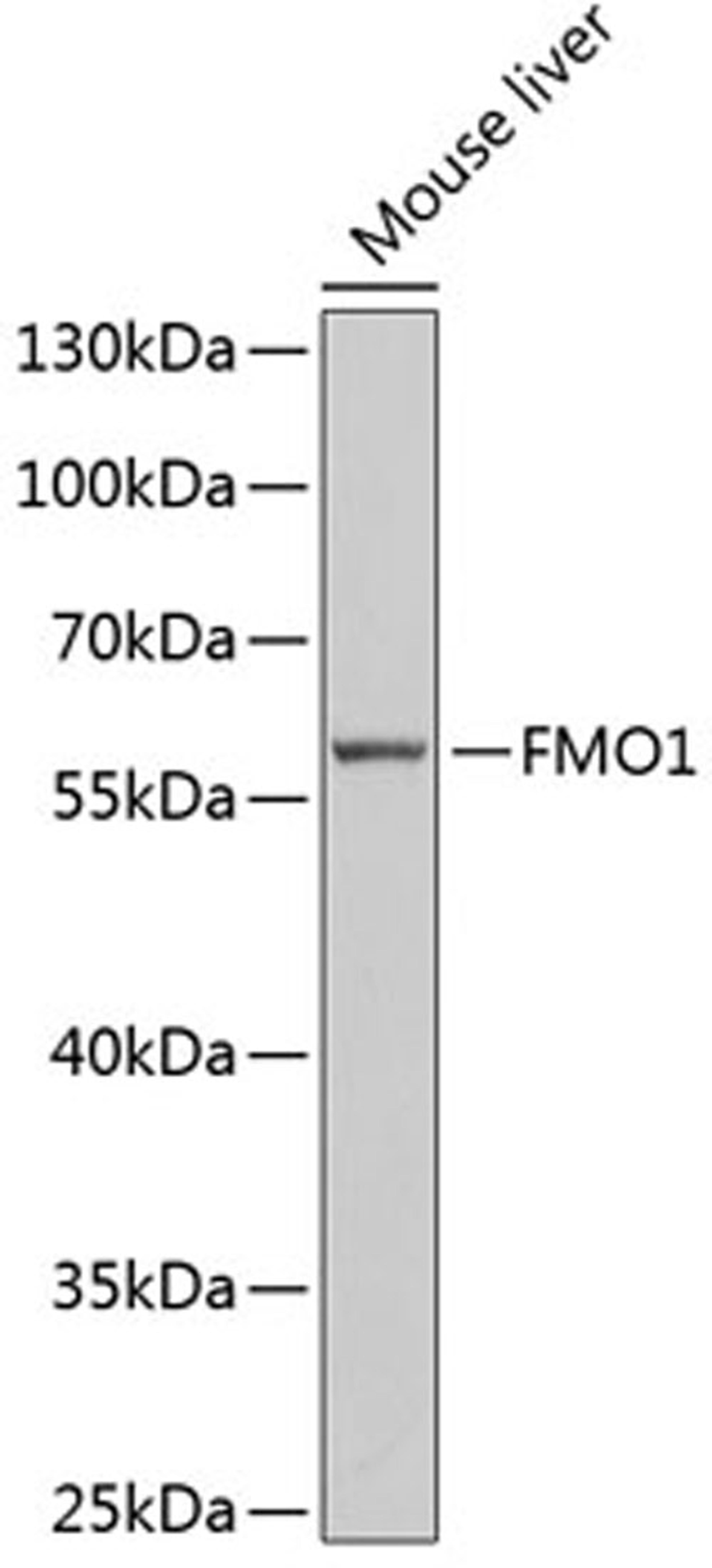 Western blot - FMO1 antibody (A6908)