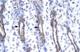 Antibody used in IHC on Human urinary bladder.