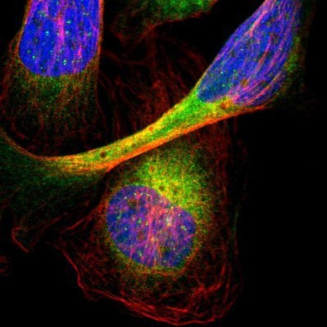 Immunocytochemistry/Immunofluorescence: SAR1 Antibody [NBP1-80789] - Staining of human cell line U-2 OS shows positivity in endoplasmic reticulum.