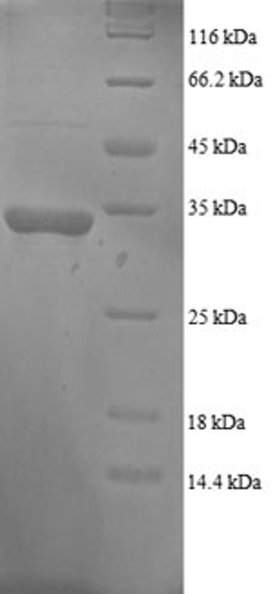 (Tris-Glycine gel) Discontinuous SDS-PAGE (reduced) with 5% enrichment gel and 15% separation gel.