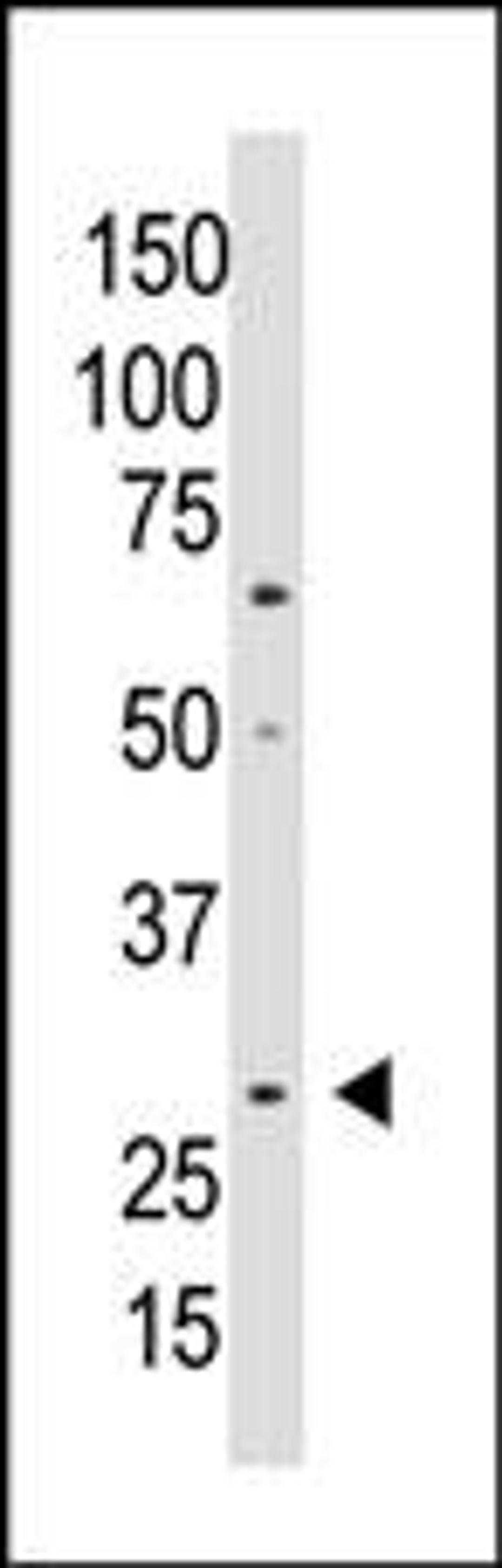 Western blot analysis of anti-WISP2 Antibody in A549 cell lysate