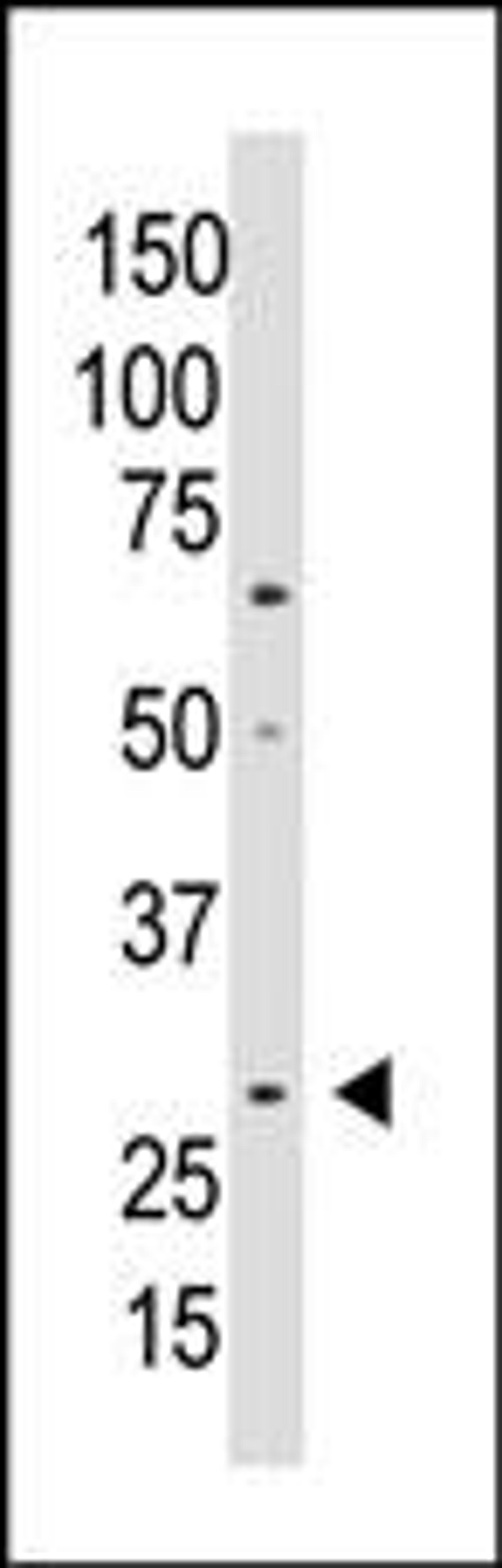 Western blot analysis of anti-WISP2 Antibody in A549 cell lysate