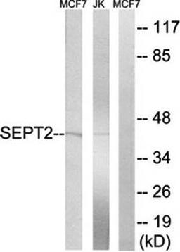 Western blot analysis of extracts from Jurkat cells and MCF-7 cells using SEPT2 antibody