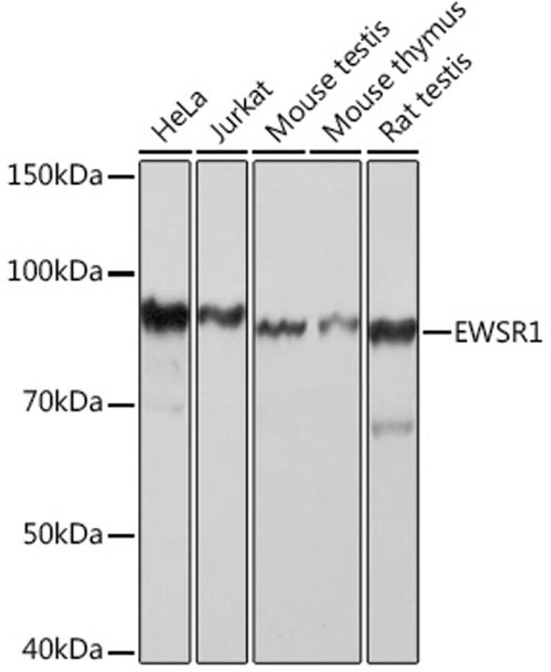 Western blot - EWSR1 Rabbit mAb (A9640)