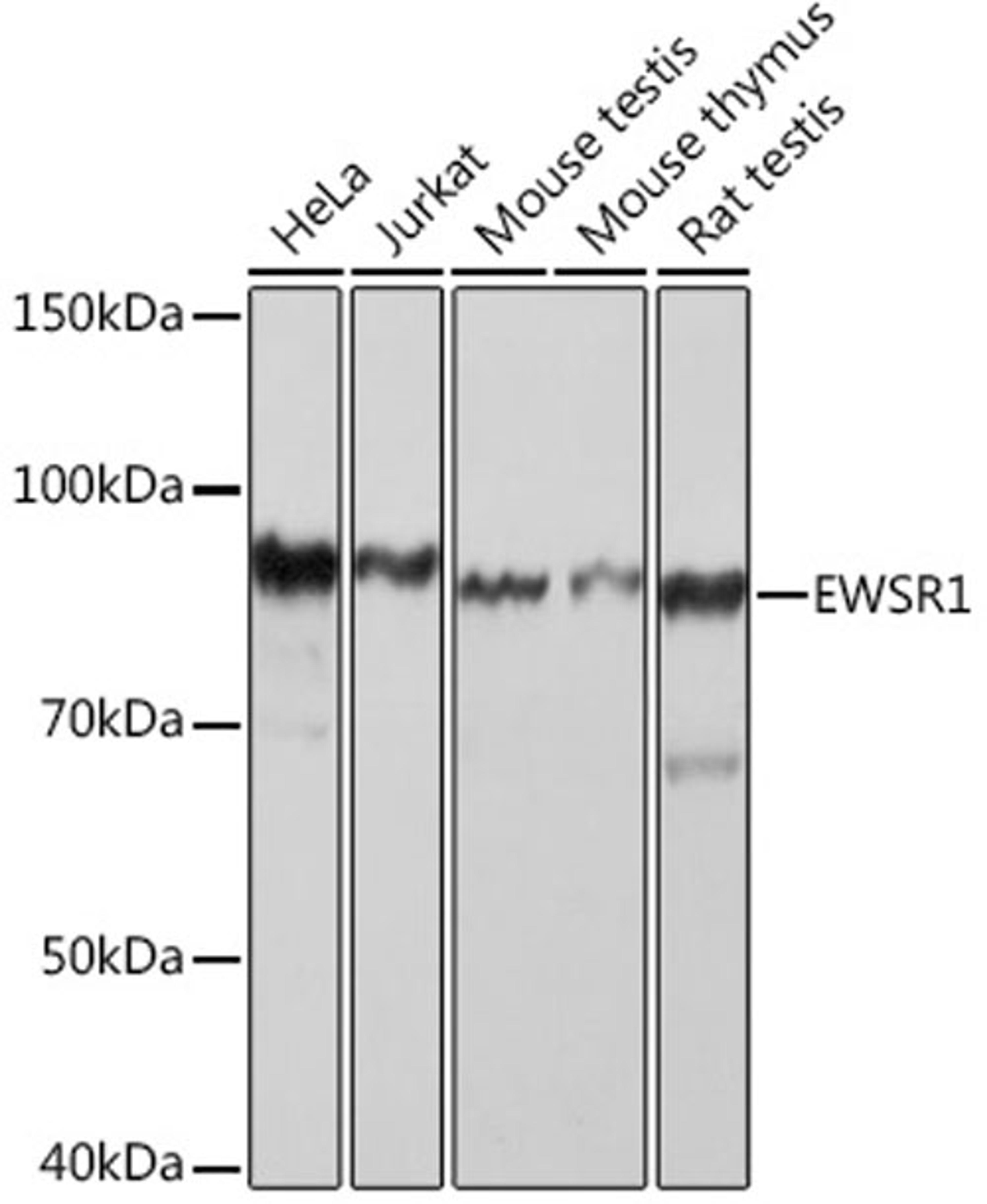 Western blot - EWSR1 Rabbit mAb (A9640)