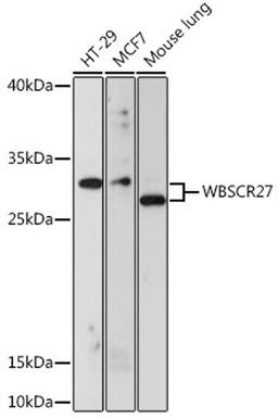 Western blot - WBSCR27 antibody (A16176)