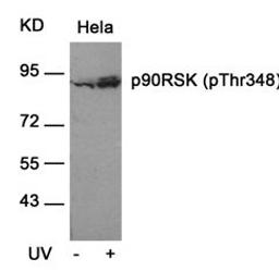 Western blot analysis of lysed extracts from HeLa cells untreated or treated with UV using p90RSK (Phospho-Thr348).