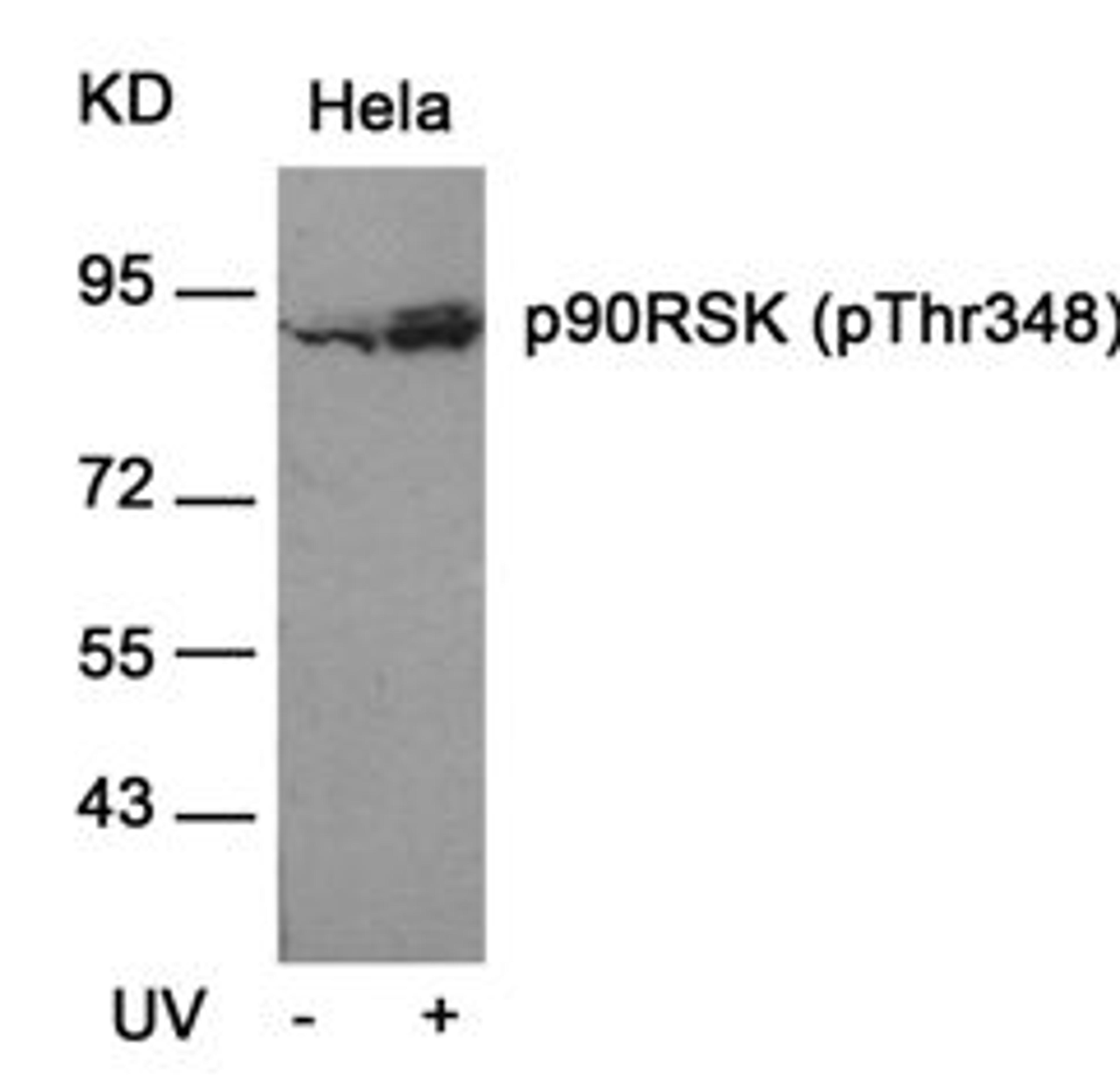 Western blot analysis of lysed extracts from HeLa cells untreated or treated with UV using p90RSK (Phospho-Thr348).