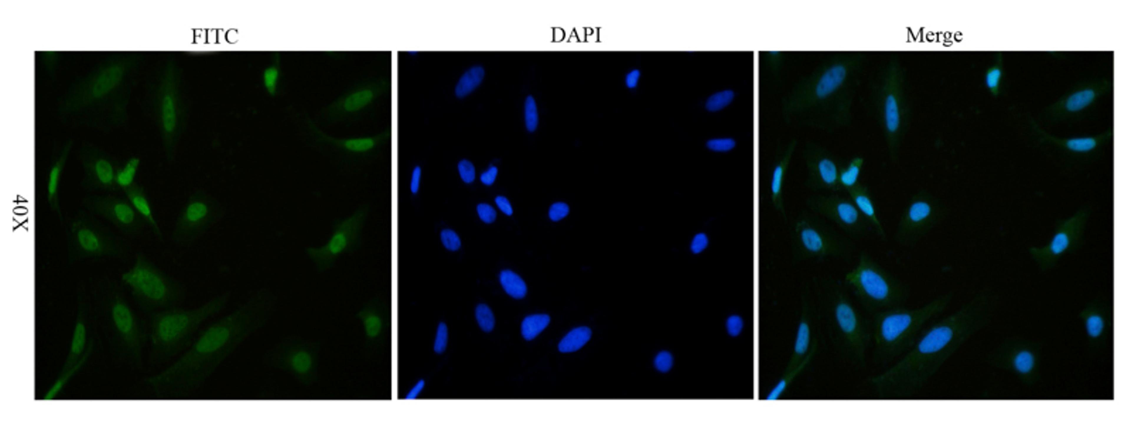 Immunofluorescence analysis of human hela cells tissue using anti-HMGB1 (dilution of primary antibody - 1:100)