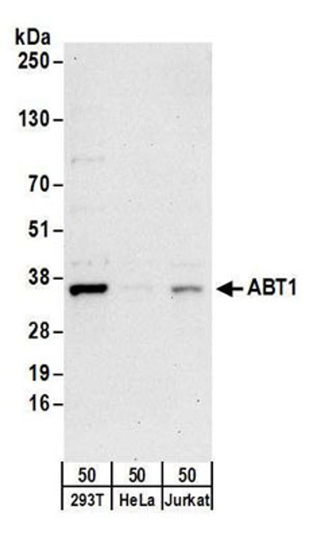 Detection of human ABT1 by western blot.